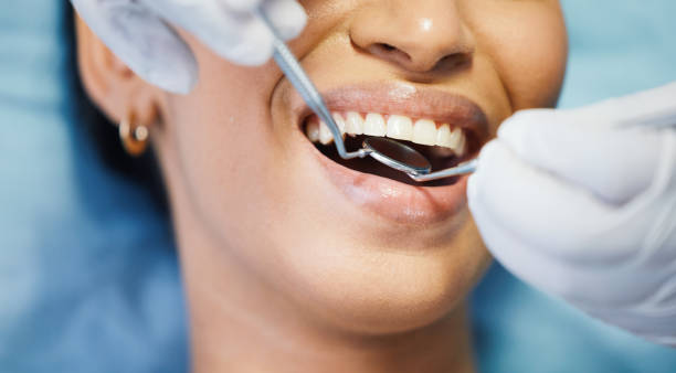 Best Emergency Dentist for Lost Fillings or Crowns in Albion, IN